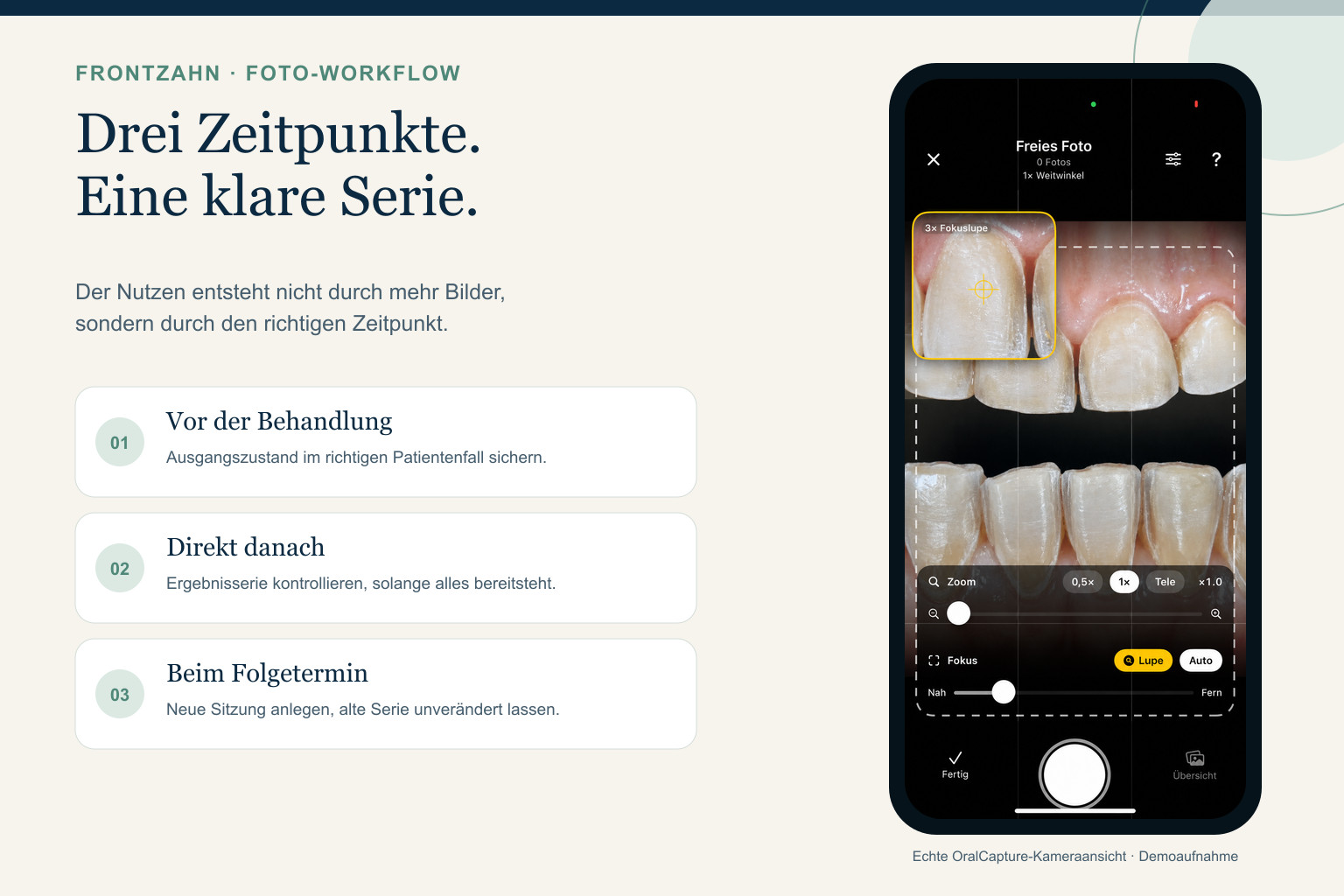 Workflow-Grafik mit Vorher-, Nachher- und Folgetermin sowie unveränderter echter OralCapture-Kameraansicht mit synthetischer Demoaufnahme