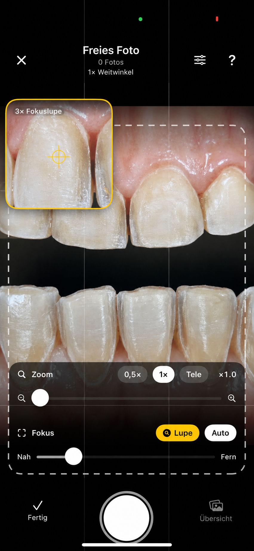 OralCapture Kameraansicht mit Frontzahnaufnahme für Patientenfotos mit dem iPhone